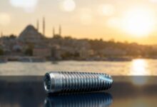 Ein einzelnes, sauberes Titan-Zahnimplantat im Vordergrund mit einer unscharfen, sonnigen Ansicht der Istanbuler Skyline und des Bosporus im Hintergrund.