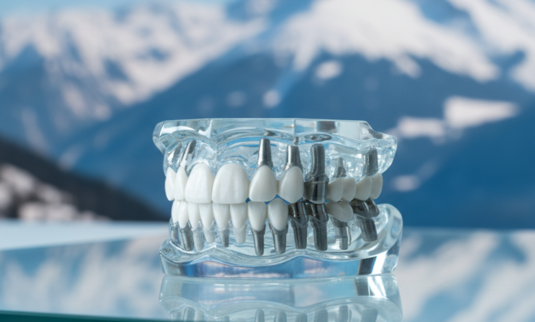 A gleaming, highly detailed full arch dental implant prosthesis in the foreground, symbolizing precision and advanced dentistry. In the soft-focus background, majestic, snow-capped Swiss Alps are visible under a clear blue sky, conveying a sense of quality and the specific location.