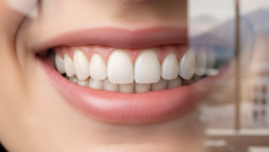 Close-up of a bright, healthy, and natural-looking smile with perfectly contoured teeth, symbolizing successful composite bonding. The background is softly blurred, hinting at a modern, high-end dental clinic setting in Switzerland. No visible text or branding.