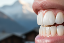 Close-up of brilliantly white, healthy human teeth with a shallow depth of field, showing a softly blurred, picturesque Swiss mountain landscape in the background.