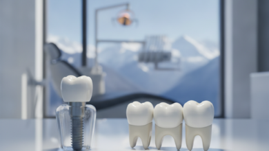 A detailed, photorealistic side-by-side comparison of a dental implant and a dental bridge on a sterile surface. The implant shows its screw, abutment, and crown, while the bridge displays two crowns supporting a central pontic. The background is a blurred, modern dental clinic with a faint, out-of-focus view of the Swiss Alps, suggesting high-standard dental care in Switzerland.