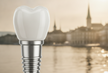 Close-up, detailed view of a gleaming, state-of-the-art dental implant and a perfectly matched porcelain crown. In the softly blurred background, the picturesque cityscape of Zurich, with its iconic lake and buildings under a bright sky, provides a sophisticated context.