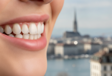 Close-up of a perfect, healthy smile with bright, aligned teeth, against a softly blurred background of the Geneva, Switzerland cityscape.