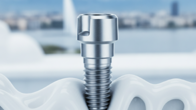 Close-up, highly detailed view of a modern dental implant, appearing as a titanium screw with an abutment, set against a sterile, blurred dental clinic backdrop. In the far distance, the iconic Jet d'Eau of Geneva is visible, dramatically out of focus, over a blurred lake and city skyline.
