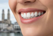 Close-up of a confident, radiant smile with perfectly white teeth and healthy gums. The background is a blurred, sophisticated urban scene hinting at Zurich, Switzerland.