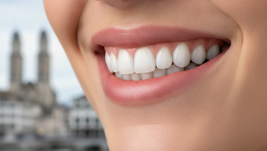 Close-up of a confident, radiant smile with perfectly white teeth and healthy gums. The background is a blurred, sophisticated urban scene hinting at Zurich, Switzerland.