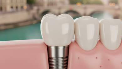 A detailed, photorealistic close-up of a perfectly crafted dental implant with a white ceramic crown, set against a softly blurred background showing the historic buildings and river of Bern, Switzerland.